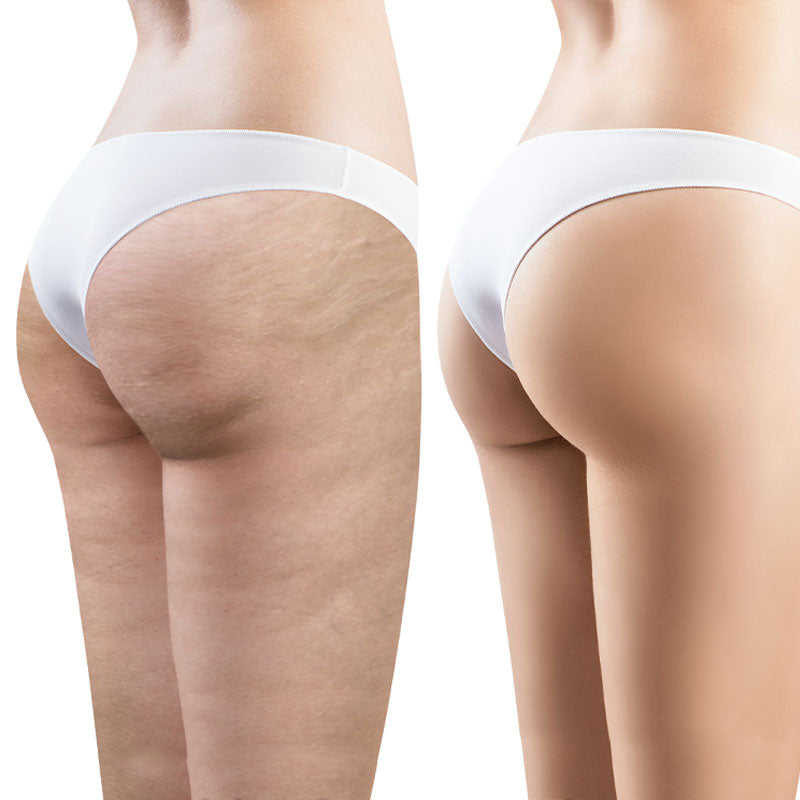 THERMO EXPRESS - Trattamento Corpo